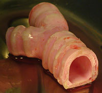 Synthetic Windpipe