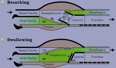 Synthetic Windpipe